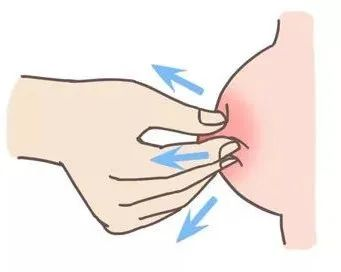 大乳頭、小乳頭、扁平乳頭、凹陷乳頭3大喂養(yǎng)指導(dǎo)及護(hù)理指南！