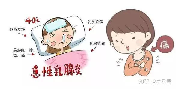 乳腺炎反復(fù)發(fā)作？這6個方法很管用