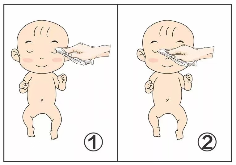 育兒百科|新生兒的眼睛十分嬌嫩，如何掌握眼部護理關鍵要點