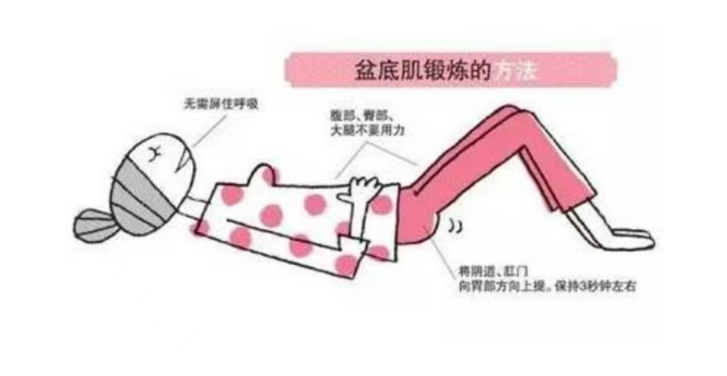 產(chǎn)后如何自己進(jìn)行盆底肌訓(xùn)練