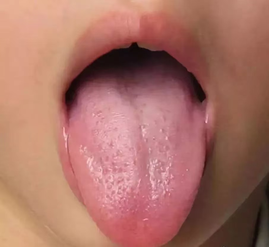 過度喂養(yǎng)危害大，寶寶發(fā)出的積食信號(hào)你能看懂多少？