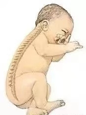 【母嬰知識(shí)】“頭”等大事，新生兒枕頭使用須知！