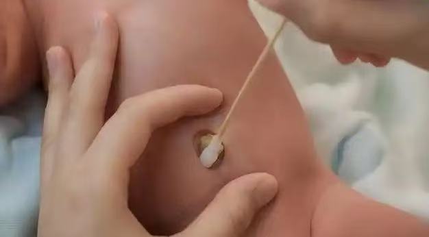  肚臍眼里的污垢，到底能不能摳？ 