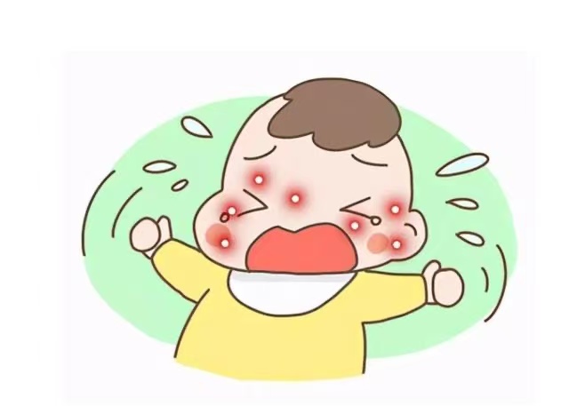 孩子濕疹反復(fù)發(fā)作怎么辦？這些防治方法請收好！
