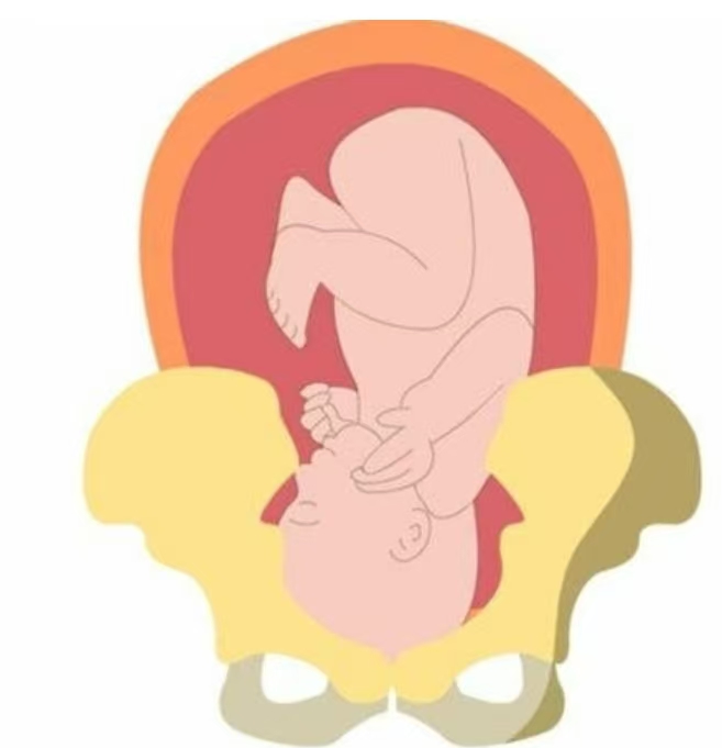 卸貨倒計時：一文讀懂“胎兒入盆”與“開宮口