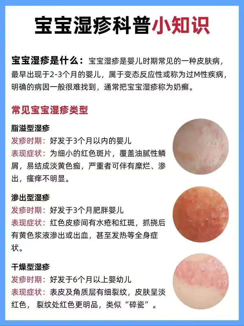 嬰兒濕疹怎么治療最好最快最有效